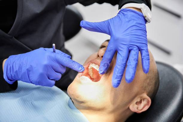 Best Teeth Whitening  in Timpson, TX